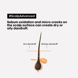 Loréal Professionnel Scalp Advanced Anti-Dandruff Shampoo 300ml
