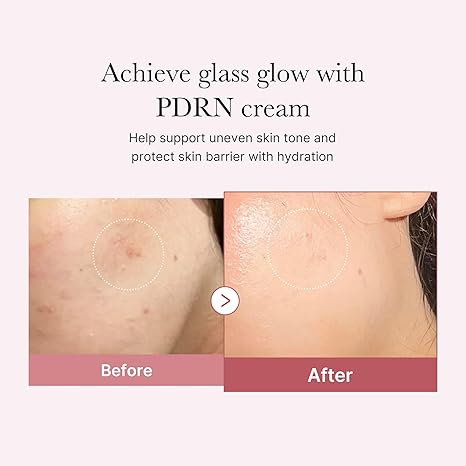 Medicube PDRN Pink Hyaluronic Moisturizing Cream (50ml)