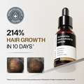 Bare Anatomy Advanced Hair Growth Serum with 3% Redensyl, 4% Anagain, 3% Bicapil & 1% Capilia Longa - 30 ml