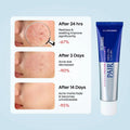 ⁠Lion Pair Acne Cream