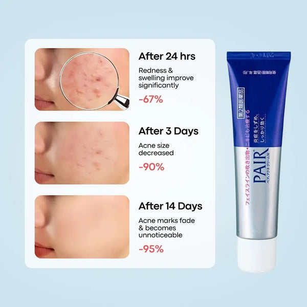 ⁠Lion Pair Acne Cream