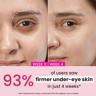 Dot & key Pomegranate + Retinol Eye Cream for Dark Circles 20ml