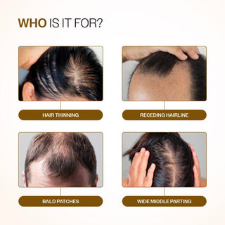 Bare Anatomy Advanced Hair Growth Serum Roll-On 25ml