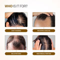 Bare Anatomy Advanced Hair Growth Serum Roll-On 25ml