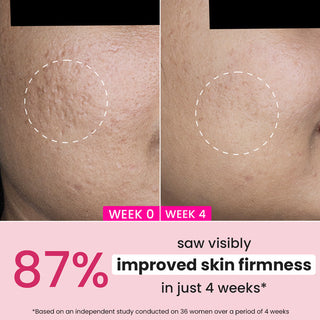 Dot & Key Pomegranate + Multi-Peptide Anti Ageing Moisturizer SPF 30