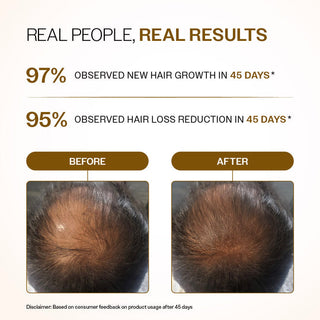 Bare Anatomy Advanced Hair Growth Serum Roll-On 25ml