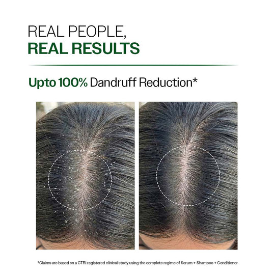 Bare Anatomy Anti Dandruff Shampoo