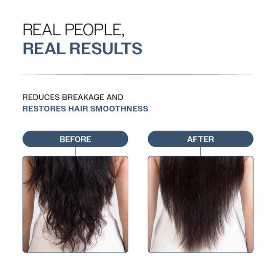 Bare Anatomy Anti-Hair Fall Conditioner 175 gm