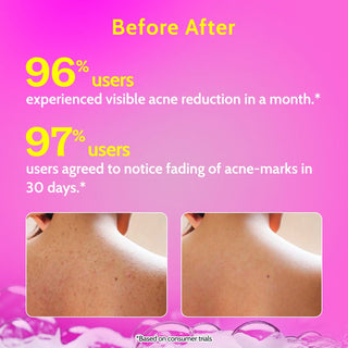 Chemist at Play 1% Salicylic Acid Body Wash for Acne Control - 236 ml