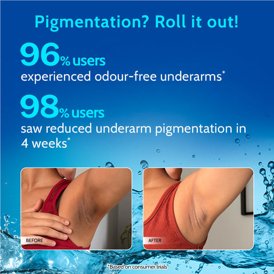 Chemist at Play 5% AHA Underarm Roll-On with Lactic Acid for Odour Control - 40 ml