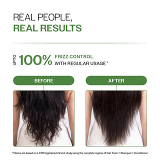 Bare Anatomy Anti-Dandruff Hair Conditioner 175gm