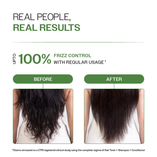 Bare Anatomy Anti-Dandruff Hair Conditioner 175gm