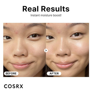 Cosrx Pure Sodium Hyaluronic Acid 3% Serum