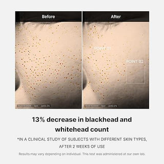 Medicube Zero Pore One-day Serum 30Ml