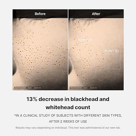 Medicube Zero Pore One-day Serum 30Ml