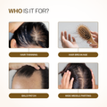 Bare Anatomy Advanced Hair Growth Serum with 3% Redensyl, 4% Anagain, 3% Bicapil & 1% Capilia Longa - 30 ml