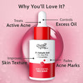 Chemist at Play 2% Salicylic Acid Face Serum for Acne Control - 30 ml