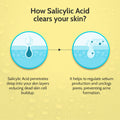 Chemist at Play 2% Salicylic Acid Face Serum for Acne Control - 30 ml