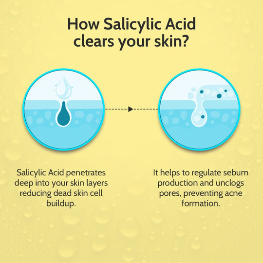 Chemist at Play 2% Salicylic Acid Face Serum for Acne Control - 30 ml