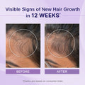 Bare Anatomy Rosemary & Hibiscus Hair Growth Oil - 100 ml