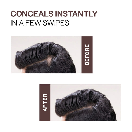 Bare Anatomy Instant Hair Cover-Up Powder - 4g