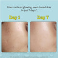 Chemist at Play 10% Vitamin C Serum for Glowing & Bright Skin - 30 ml
