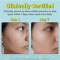 Chemist at Play 10% Vitamin C Serum for Glowing & Bright Skin - 30 ml