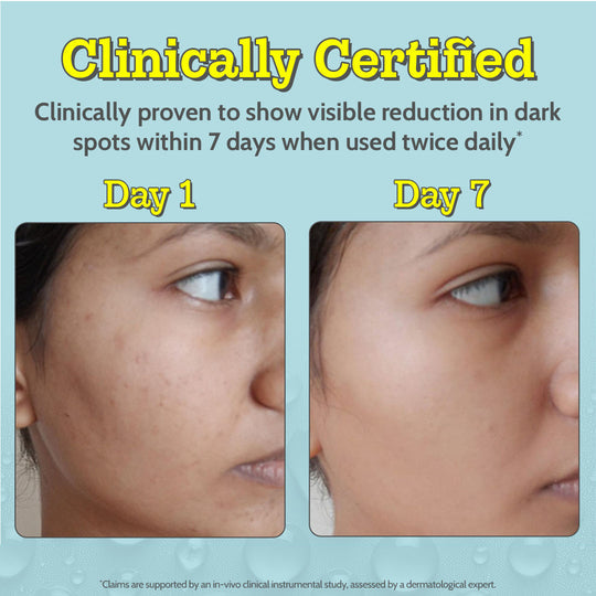 Chemist at Play 10% Vitamin C Serum for Glowing & Bright Skin - 30 ml