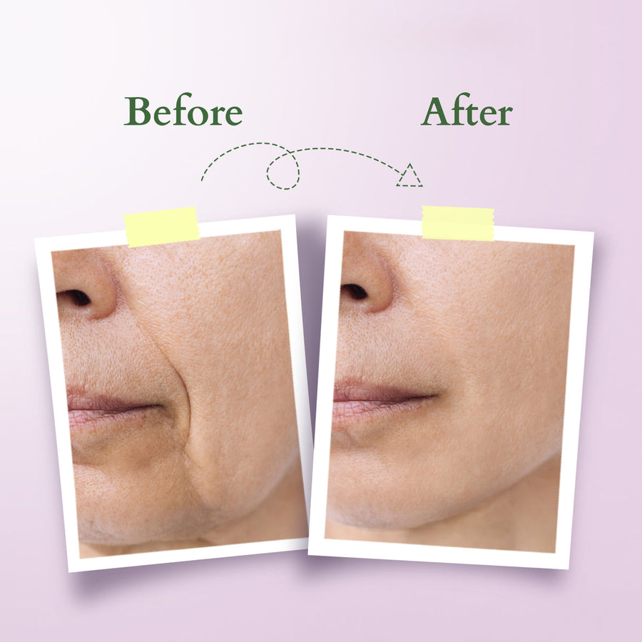 Lotus Organic Bakuchiol Plant Retinol Miracle Face Oil 15ml