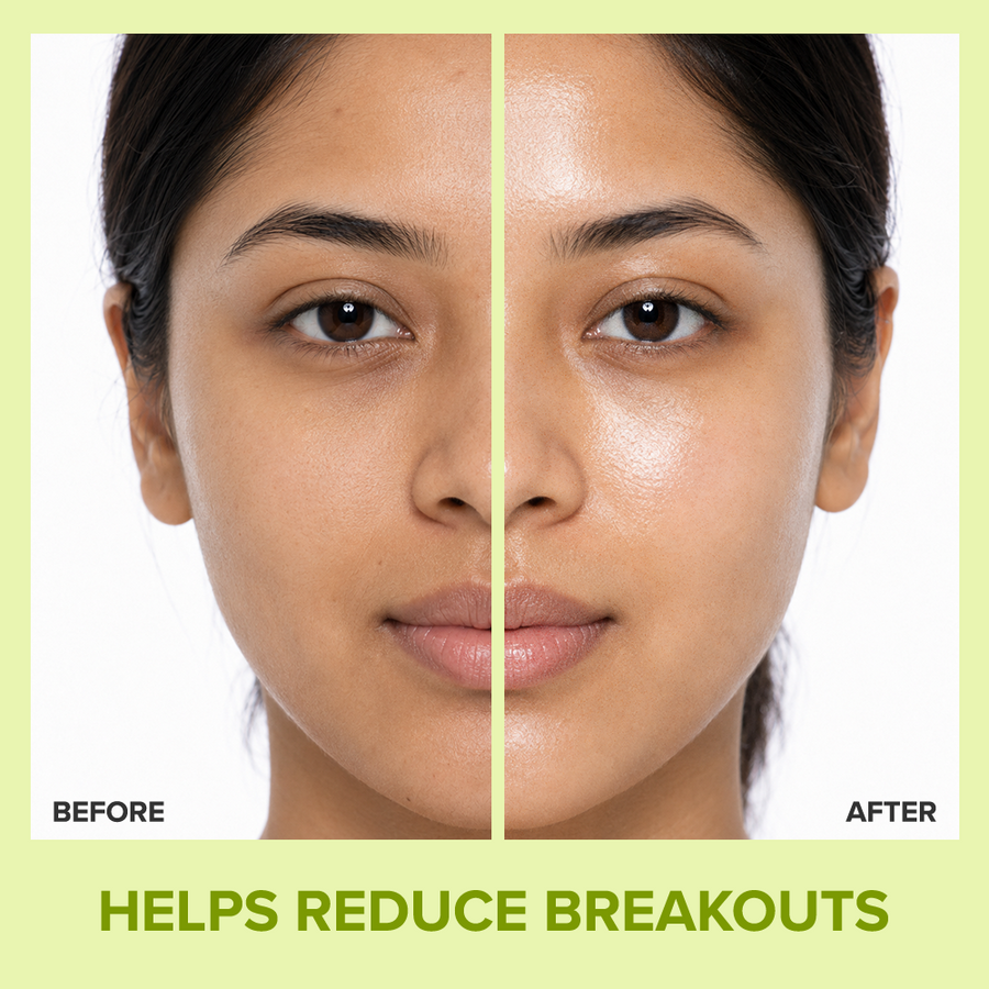 Forever 52 Acne Care Hydrating Moisturiser