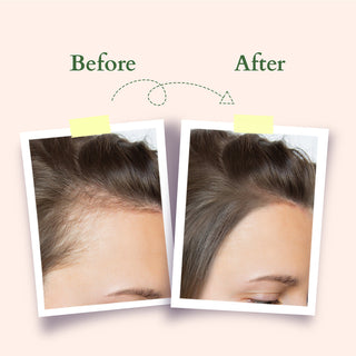 Lotus Organic Organics+ Hair Fall Control Shampoo 300ml