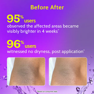 Chemist at Play Neck, Knee & Elbow Brightening Roll On - 40 ml