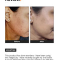 Minimalist Niacinamide 10% Face Serum 30ml
