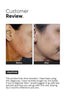 Minimalist Niacinamide 10% Face Serum 30ml