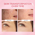 RENEE Pink Therapy PDRN Pink Peptide Serum For Hydrated & Radiant Skin, 30 ml