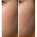 Dermacy Senicil Advanced Daily Moisturising Cream