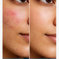 Dermacy Senicil Advanced Gentle Cleanser