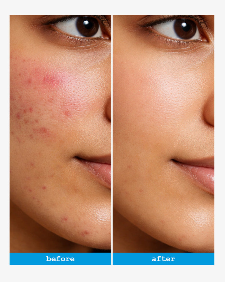 Dermacy Senicil Advanced Gentle Cleanser