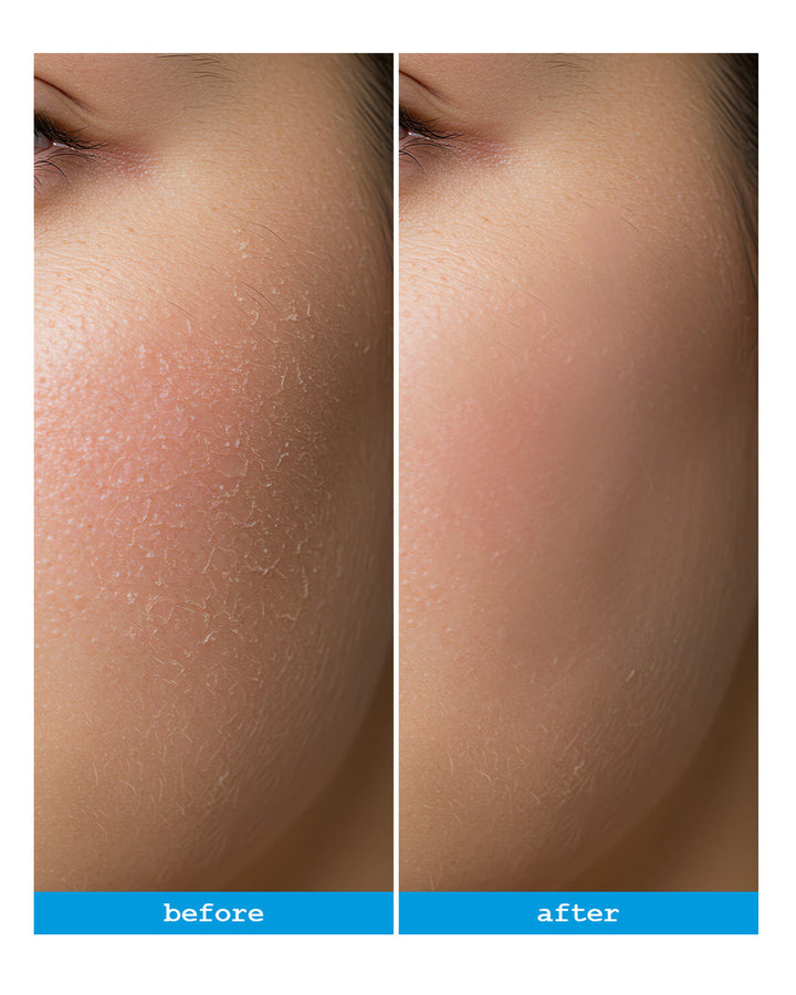 Dermacy Senicil Advanced Daily Moisturising Cream