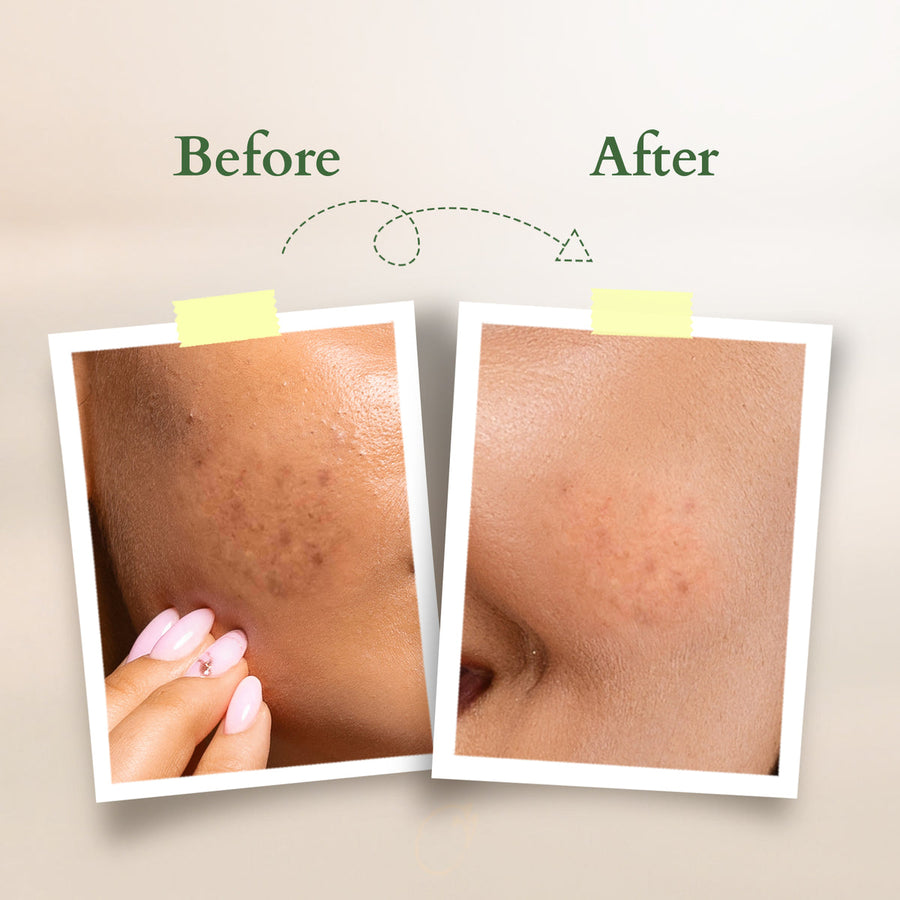 Lotus Organics+ Vitamin-C Radiance Booster Cleanser 100gm