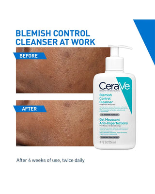 Cerave Blemish Control Cleanser
