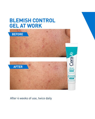 Cerave Blemish Control Gel 40ml