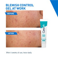 Cerave Blemish Control Gel 40ml