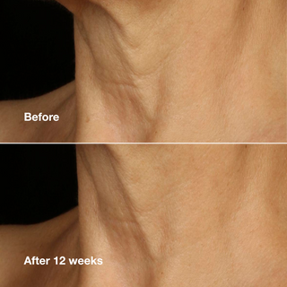 Clinique Smart Clinical Repair™ Lifting Face + Neck Cream