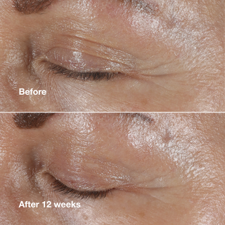 Clinique Smart Clinical Repair™ Wrinkle Correcting Eye Cream