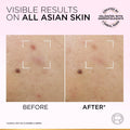 L’Oréal Paris Glycolic-Bright Anti Dark Spot Exfoliant Peel