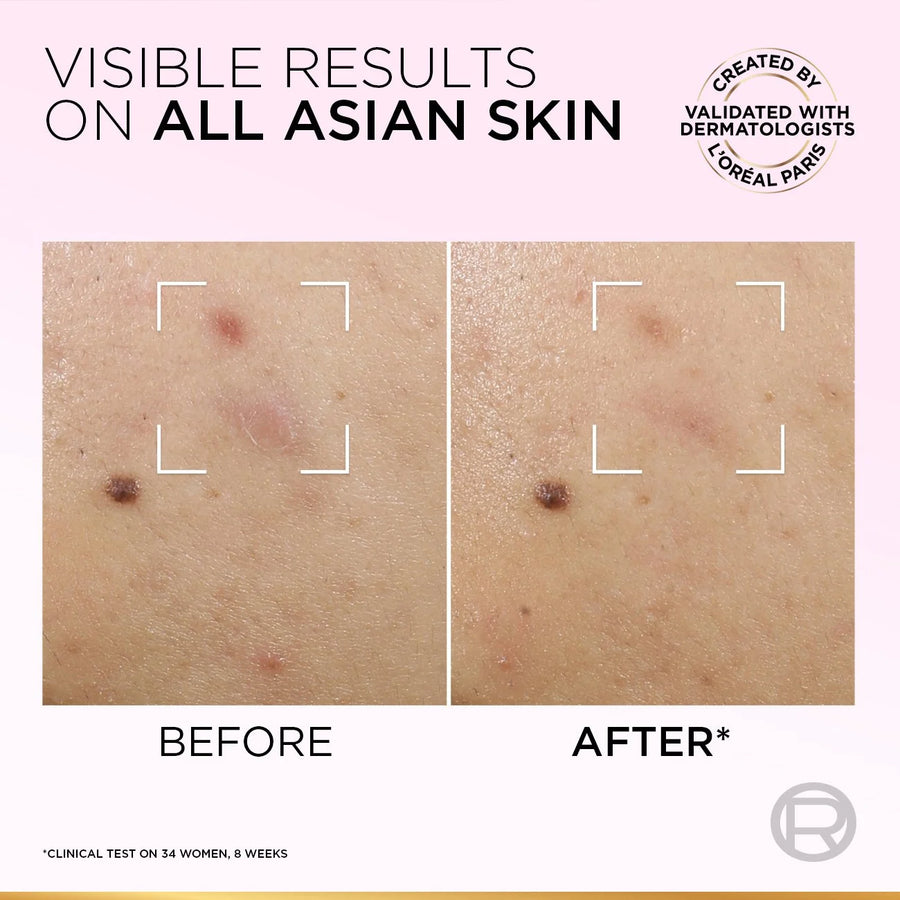 L’Oréal Paris Glycolic-Bright Anti Dark Spot Exfoliant Peel