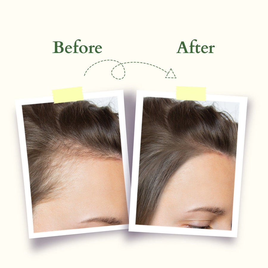 Lotus Organics+ Intensive Scalp Revitalizing Oil 100ml
