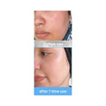 Medicube Hyaluronic Ceramide Jelly Cream 50ml
