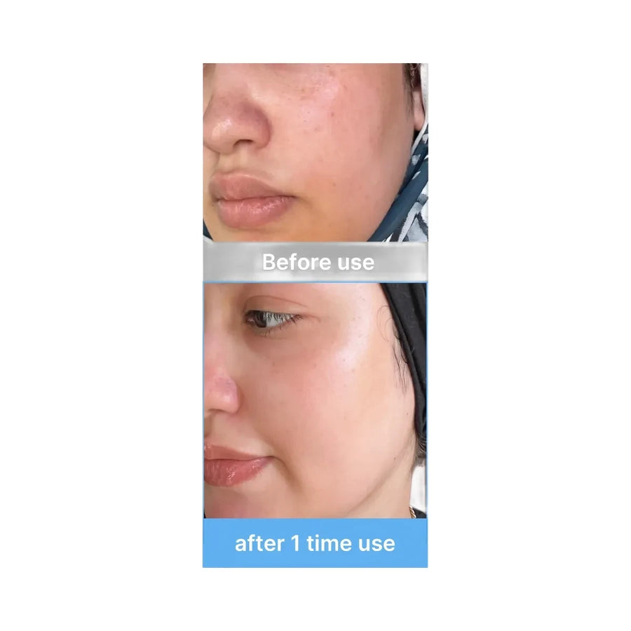 Medicube Hyaluronic Ceramide Jelly Cream 50ml
